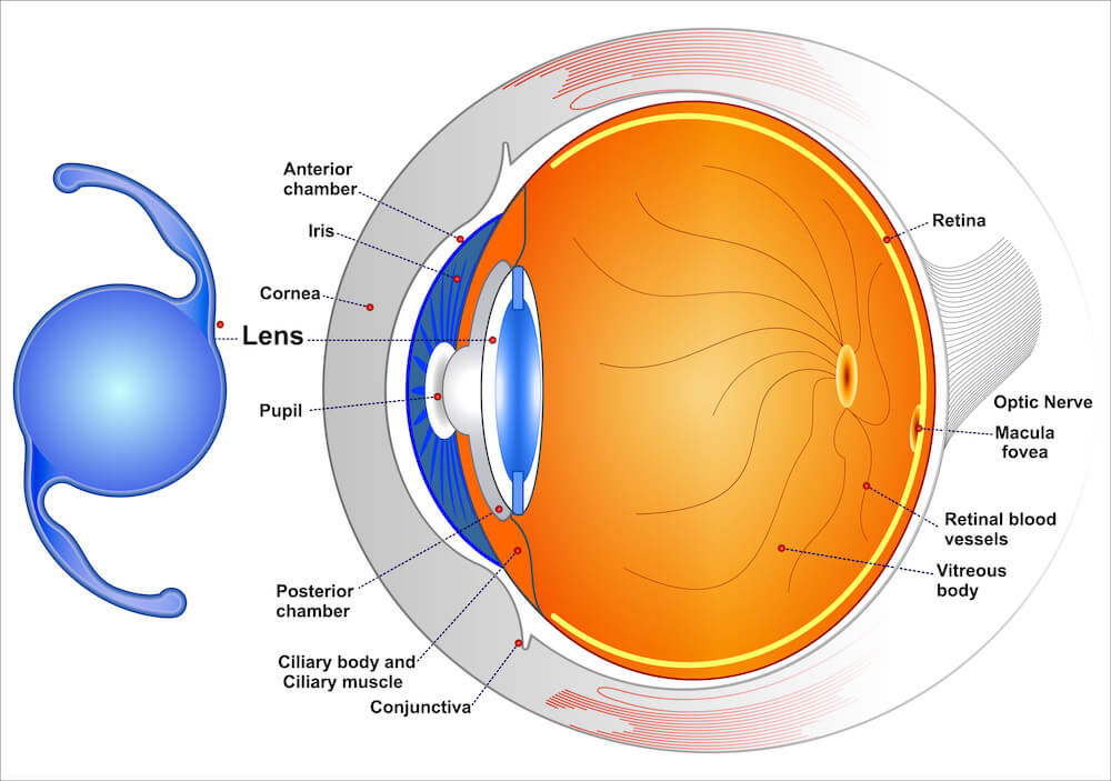 Diagram of conventional interocular lens